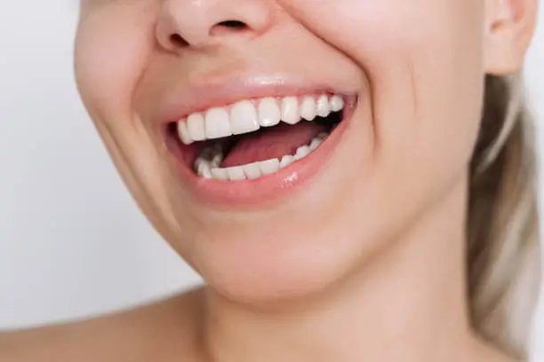 veneers lifespan how to maximize their durability