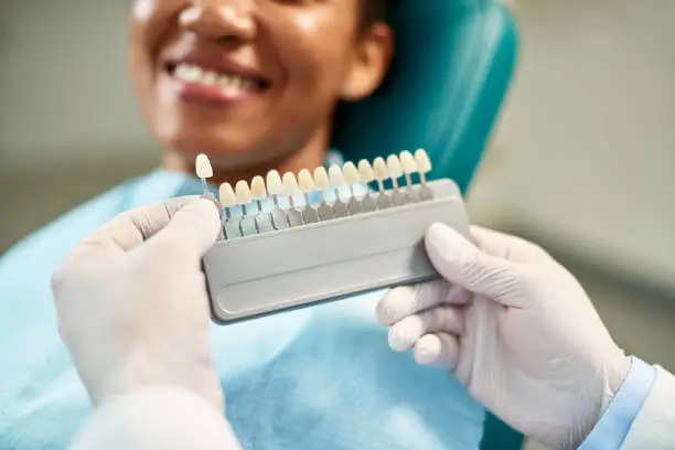 veneers lifespan how to maximize their durability2