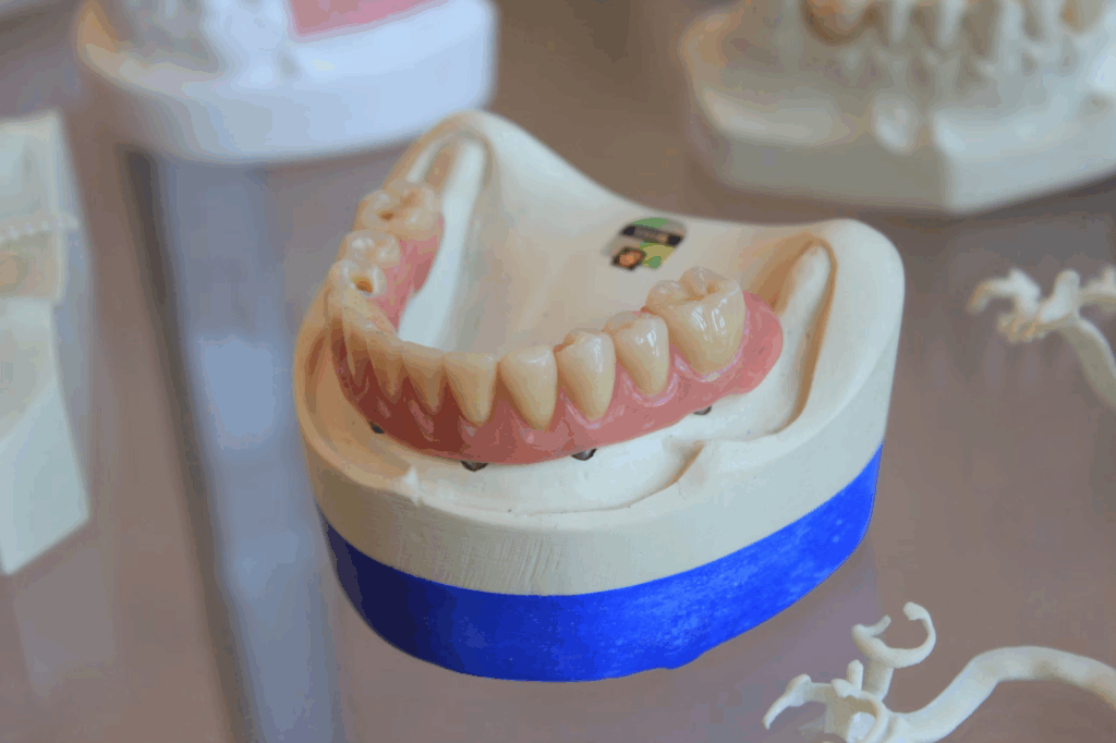 image of a life-like dental model of the lower teeth