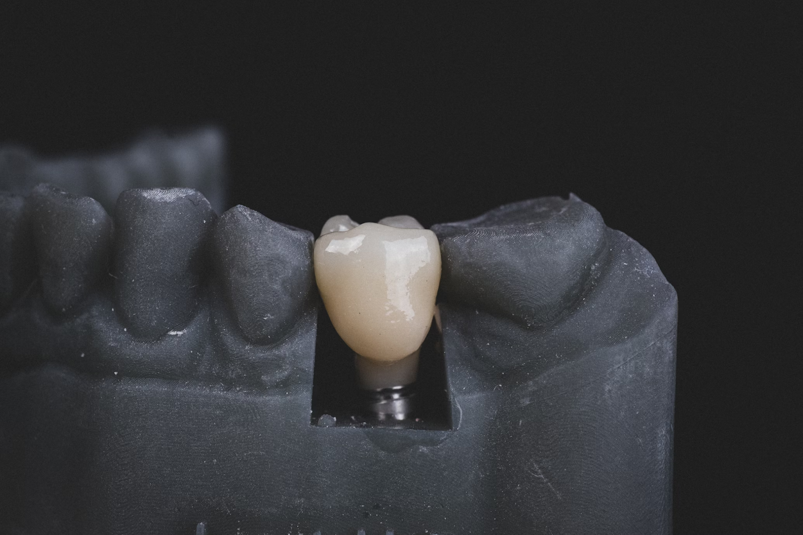 a dental implant on a black dental model